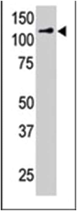 USP4 Rabbit anti-Human, Polyclonal Antibody, Abnova 400&mu;L; Unlabeled:Antibodies,