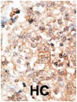 BGLAP, Rabbit, Polyclonal Antibody, Abnova 400&mu;L; Unlabeled:Antibodies,