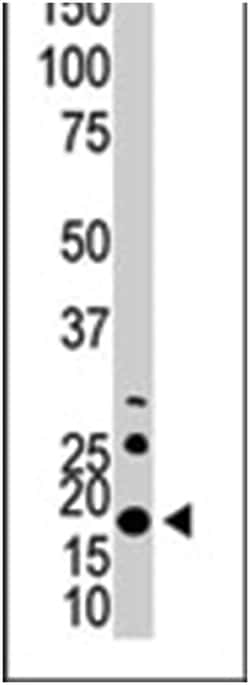Calmodulin, Rabbit, Polyclonal Antibody, Abnova 400 &mu;L | Buy Online | Abnova Corporation | Fisher Scientific