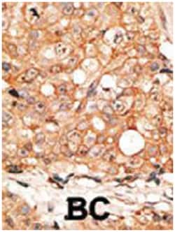 Calmodulin, Rabbit, Polyclonal Antibody, Abnova 400 &mu;L | Buy Online | Abnova Corporation | Fisher Scientific