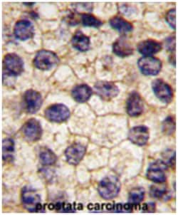 PDGFRA Rabbit anti-Human, Polyclonal Antibody, Abnova 400 &mu;L | Buy Online | Abnova Corporation | Fisher Scientific