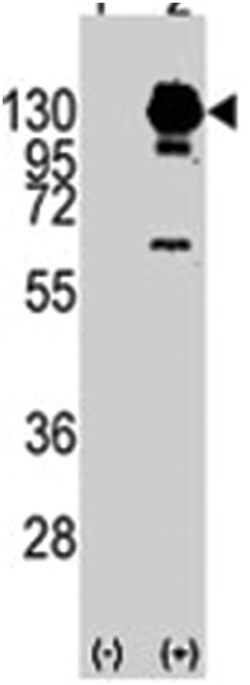 PDGFRA Rabbit anti-Human, Polyclonal Antibody, Abnova 400 &mu;L | Buy Online | Abnova Corporation | Fisher Scientific