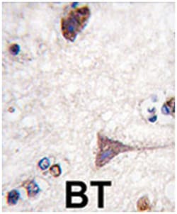 BRAF Rabbit anti-Human, Polyclonal Antibody, Abnova 400&mu;L; Unlabeled:Antibodies,