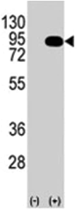 BRAF Rabbit anti-Human, Polyclonal Antibody, Abnova 400&mu;L; Unlabeled:Antibodies,
