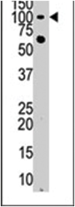 HK3 Rabbit anti-Human, Polyclonal Antibody, Abnova 400 &mu;L | Buy Online | Abnova Corporation | Fisher Scientific