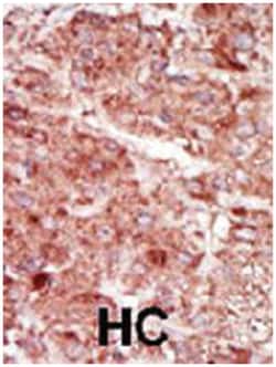 HK3 Rabbit anti-Human, Polyclonal Antibody, Abnova 400 &mu;L | Buy Online | Abnova Corporation | Fisher Scientific