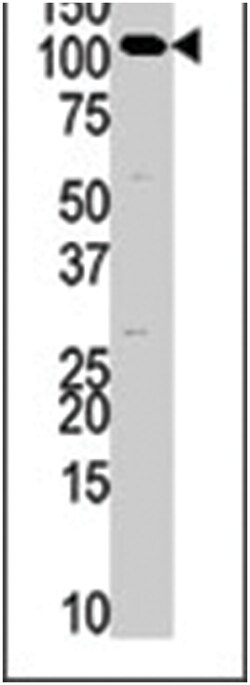 HK3 Rabbit anti-Human, Polyclonal Antibody, Abnova 400 &mu;L | Buy Online | Abnova Corporation | Fisher Scientific
