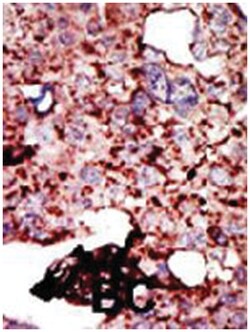 HK1 Rabbit anti-Human, Polyclonal Antibody, Abnova 400 &mu;L | Buy Online | Abnova Corporation | Fisher Scientific