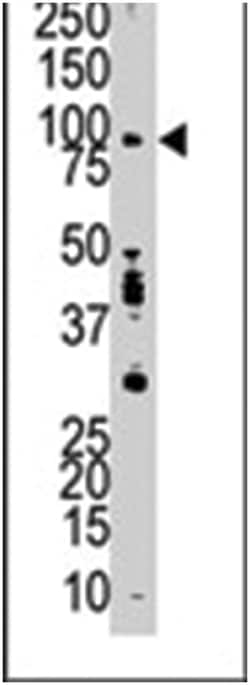 EPS8, Rabbit, Polyclonal Antibody, Abnova 400 &mu;L | Buy Online | Abnova Corporation | Fisher Scientific
