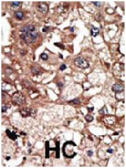 EPS8, Rabbit, Polyclonal Antibody, Abnova 400 &mu;L | Buy Online | Abnova Corporation | Fisher Scientific