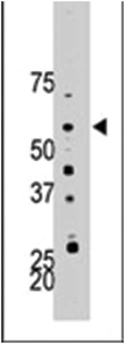PFKFB4, Rabbit, Polyclonal Antibody, Abnova 400&mu;L; Unlabeled:Antibodies,