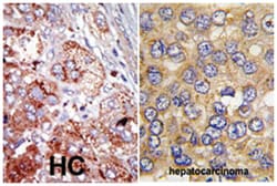 PFKFB4, Rabbit, Polyclonal Antibody, Abnova 400&mu;L; Unlabeled:Antibodies,