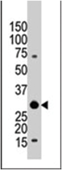 YWHAB Rabbit anti-Human, Polyclonal Antibody, Abnova 400 &mu;L | Buy Online | Abnova Corporation | Fisher Scientific