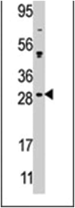 CIB2, Rabbit, Polyclonal Antibody, Abnova 400&mu;L; Unlabeled:Antibodies,