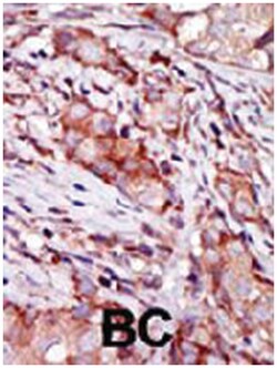 CIB2, Rabbit, Polyclonal Antibody, Abnova 400&mu;L; Unlabeled:Antibodies,