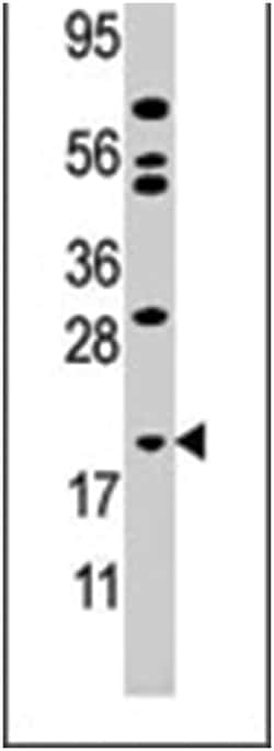 AK1 Rabbit anti-Human, Polyclonal Antibody, Abnova 400 &mu;L | Buy Online | Abnova Corporation | Fisher Scientific