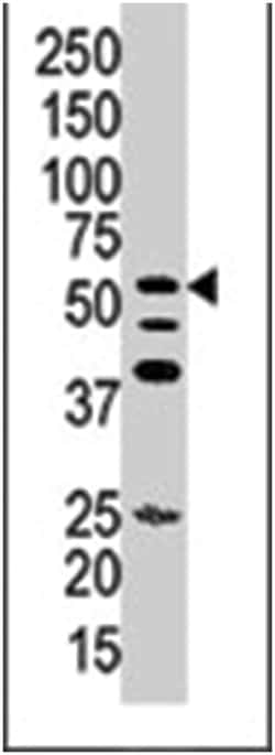 ITPKA Rabbit anti-Human, Polyclonal Antibody, Abnova 400&mu;L; Unlabeled:Antibodies,