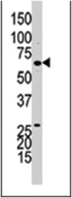 GUCY1B3 Rabbit anti-Human, Polyclonal Antibody, Abnova 400&mu;L; Unlabeled:Antibodies,