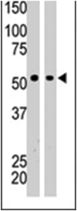 BAIAP2, Rabbit, Polyclonal Antibody, Abnova 400&mu;L; Unlabeled:Antibodies,