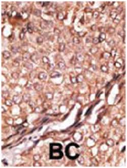 BAIAP2, Rabbit, Polyclonal Antibody, Abnova 400&mu;L; Unlabeled:Antibodies,