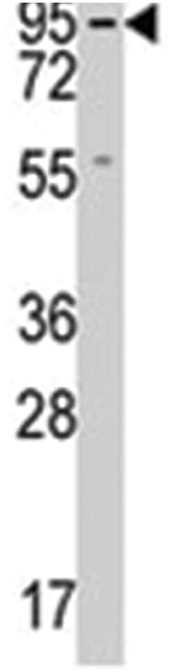 GUCY1A2 Rabbit anti-Human, Polyclonal Antibody, Abnova 400&mu;L; Unlabeled:Antibodies,