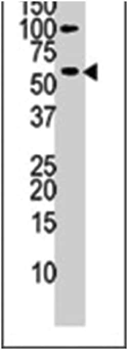 CHKA Rabbit anti-Human, Polyclonal Antibody, Abnova 400&mu;L; Unlabeled:Antibodies,