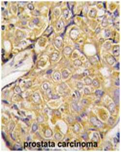 TRPM8 Rabbit anti-Human, Polyclonal Antibody, Abnova 400&mu;L; Unlabeled:Antibodies,