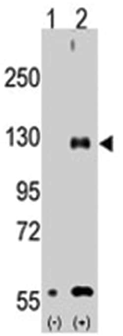 TRPM8 Rabbit anti-Human, Polyclonal Antibody, Abnova 400&mu;L; Unlabeled:Antibodies,