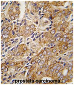 TRPM8 Rabbit anti-Human, Polyclonal Antibody, Abnova 400&mu;L; Unlabeled:Antibodies,