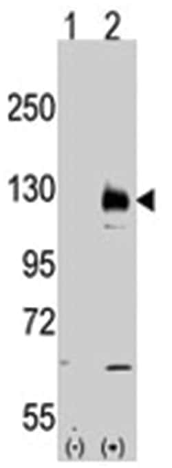 TRPM8 Rabbit anti-Human, Polyclonal Antibody, Abnova 400&mu;L; Unlabeled:Antibodies,