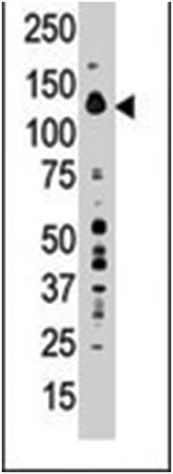 PTPN21, Rabbit, Polyclonal Antibody, Abnova 400 &mu;L | Buy Online | Abnova Corporation | Fisher Scientific