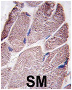 PTPN21, Rabbit, Polyclonal Antibody, Abnova 400 &mu;L | Buy Online | Abnova Corporation | Fisher Scientific