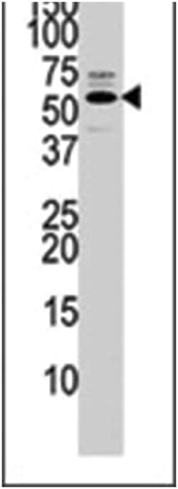 PTEN Rabbit anti-Human, Polyclonal Antibody, Abnova 400 &mu;L | Buy Online | Abnova Corporation | Fisher Scientific