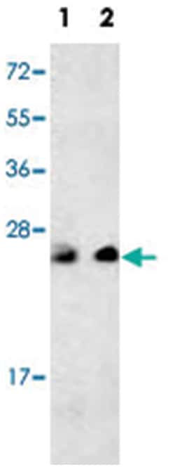 PTP4A3 Rabbit anti-Human, Polyclonal Antibody, Abnova 400 &mu;L | Buy Online | Abnova Corporation | Fisher Scientific