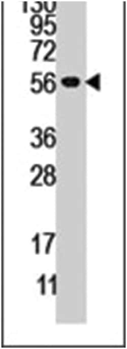 DUSP4, Rabbit, Polyclonal Antibody, Abnova 400&mu;L; Unlabeled:Antibodies,