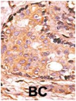 DUSP4, Rabbit, Polyclonal Antibody, Abnova 400&mu;L; Unlabeled:Antibodies,