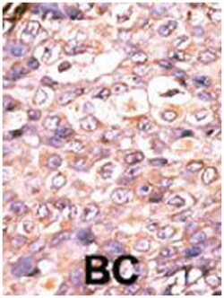 DUSP7, Rabbit, Polyclonal Antibody, Abnova 400&mu;L; Unlabeled:Antibodies,