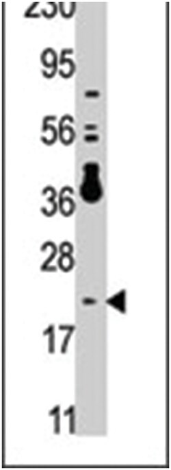DUSP13 Rabbit anti-Human, Polyclonal Antibody, Abnova 400 &mu;L | Buy Online | Abnova Corporation | Fisher Scientific