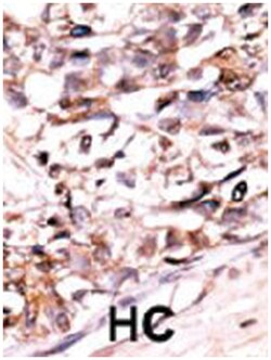 DUSP13 Rabbit anti-Human, Polyclonal Antibody, Abnova 400 &mu;L | Buy Online | Abnova Corporation | Fisher Scientific