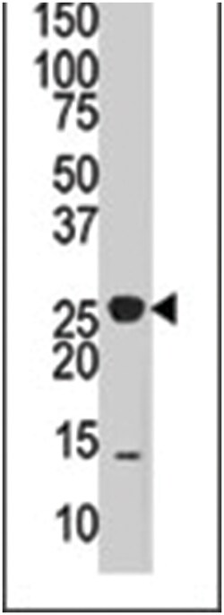 DUSP14 Rabbit anti-Human, Mouse, Polyclonal Antibody, Abnova 400&mu;L;
