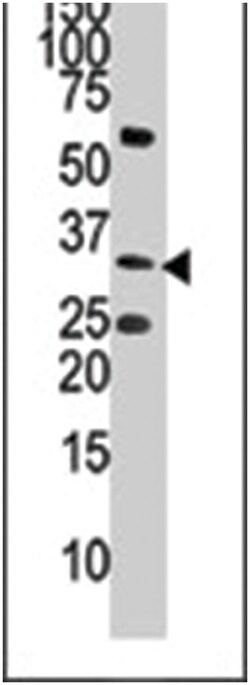 CTDSP1, Rabbit, Polyclonal Antibody, Abnova 400 &mu;L | Buy Online | Abnova | Fisher Scientific