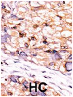 CTDSP1, Rabbit, Polyclonal Antibody, Abnova 400 &mu;L | Buy Online | Abnova | Fisher Scientific