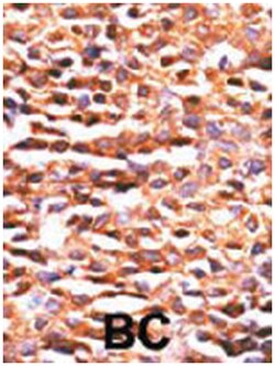 PPP2CA Rabbit anti-Human, Polyclonal Antibody, Abnova 400 &mu;L | Buy Online | Abnova Corporation | Fisher Scientific
