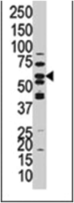 PPP3CC Rabbit anti-Human, Polyclonal Antibody, Abnova 400 &mu;L | Buy Online | Abnova Corporation | Fisher Scientific