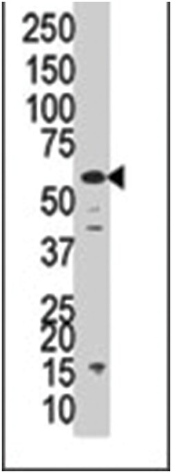 PPP3CC Rabbit anti-Human, Polyclonal Antibody, Abnova 400 &mu;L | Buy Online | Abnova | Fisher Scientific