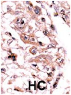 PPP3CC Rabbit anti-Human, Polyclonal Antibody, Abnova 400 &mu;L | Buy Online | Abnova | Fisher Scientific
