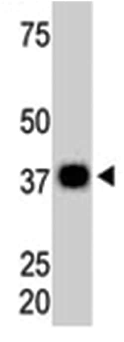 PPP6C, Rabbit, Polyclonal Antibody, Abnova 400 &mu;L | Buy Online | Abnova Corporation | Fisher Scientific