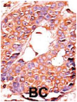 PPP6C, Rabbit, Polyclonal Antibody, Abnova 400 &mu;L | Buy Online | Abnova Corporation | Fisher Scientific