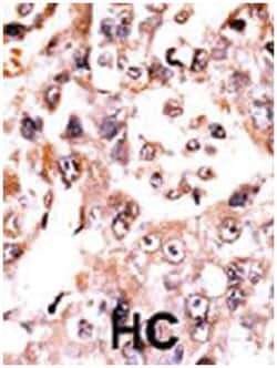 DUSP3 Rabbit anti-Human, Polyclonal Antibody, Abnova 400 &mu;L | Buy Online | Abnova Corporation | Fisher Scientific