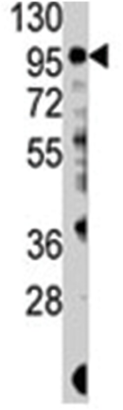 PIK3CG Rabbit anti-Human, Polyclonal Antibody, Abnova 400 &mu;L | Buy Online | Abnova | Fisher Scientific